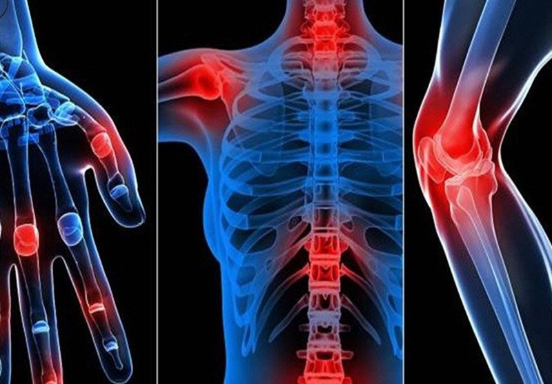 العلاج الأقوى لآلام المفاصل قبل اللجوء إلى الأدوية والجراحة