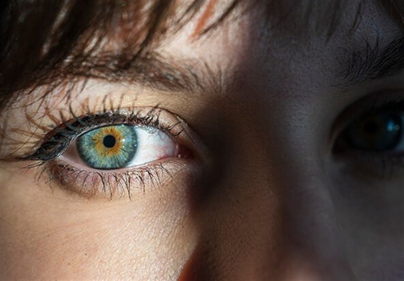 عوارض خطرناک عمل تغییر رنگ چشم