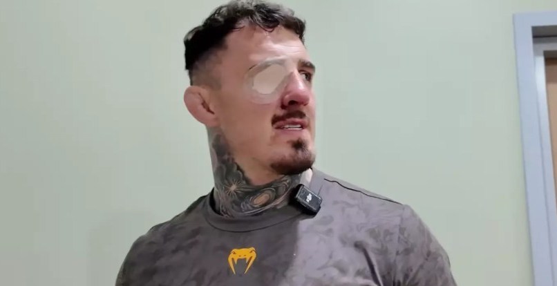 تام آسپینال در میانه تردیدها و انتقادها 2