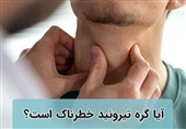 آیا گره تیروئید خطرناک و نگران کننده است؟