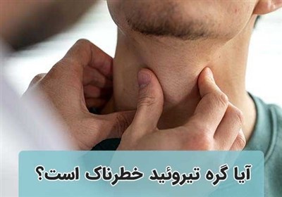 آیا گره تیروئید خطرناک و نگران کننده است؟